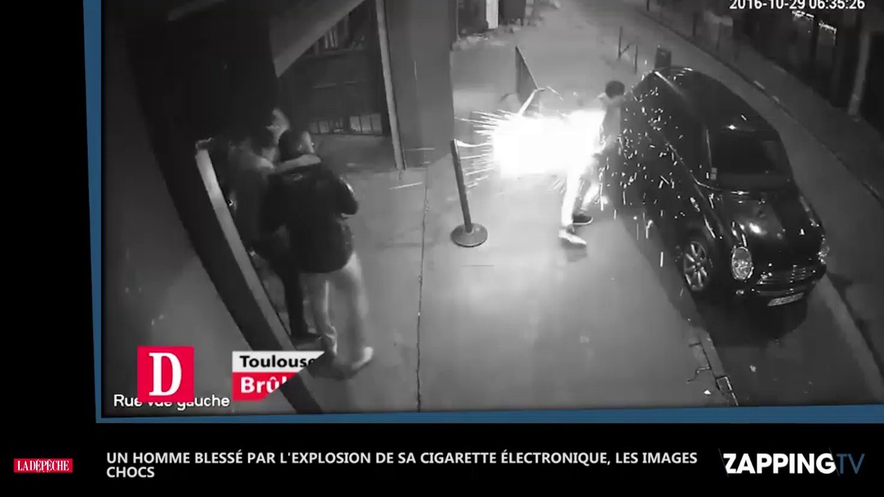 Un homme brûlé par l’explosion de sa cigarette électronique, les images chocs