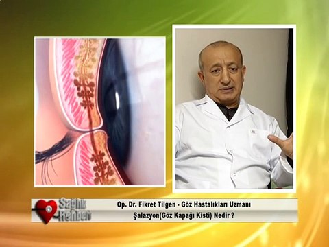 Meltem Hastanesi | Şalazyon Ameliyatı ve Tedavisi