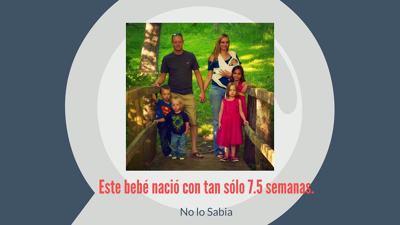 Este bebé nació con tan sólo 7.5 semanas.