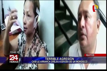 Iquitos: casi le arranca la oreja a esposa de un mordisco