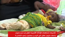 افتتاح 30 مركزا لاستقبال حالات سوء التغذية باليمن