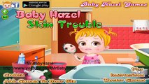 Baby Hazel Skin Trouble - Games-Baby Movie level 1