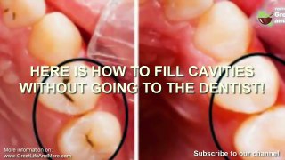 HERE IS HOW TO FILL CAVITIES WITHOUT GOING TO THE DENTIST!