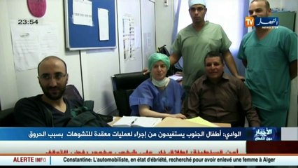 الوادي  أطفال الجنوب يستفيدون من إجراء لعمليات معقدة للتشوهات بسبب الحروق