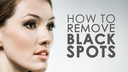 How to Remove Black Spots on Face