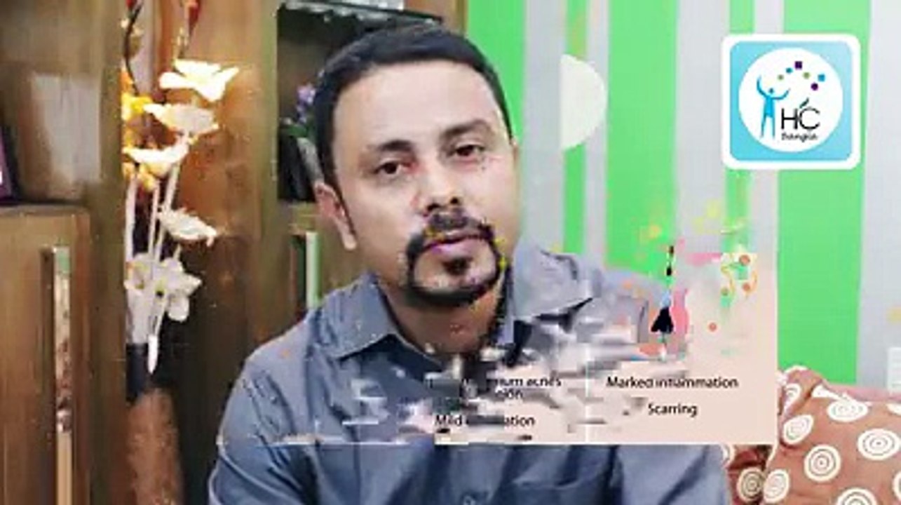 ব্রণ কেনো হয় ও তার প্রতিকার কি জেনে নিন(360p)