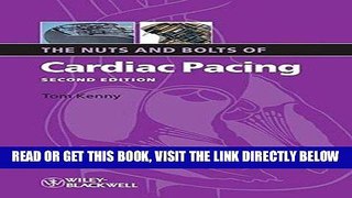 [FREE] EBOOK The Nuts and Bolts of Cardiac Pacing ONLINE COLLECTION
