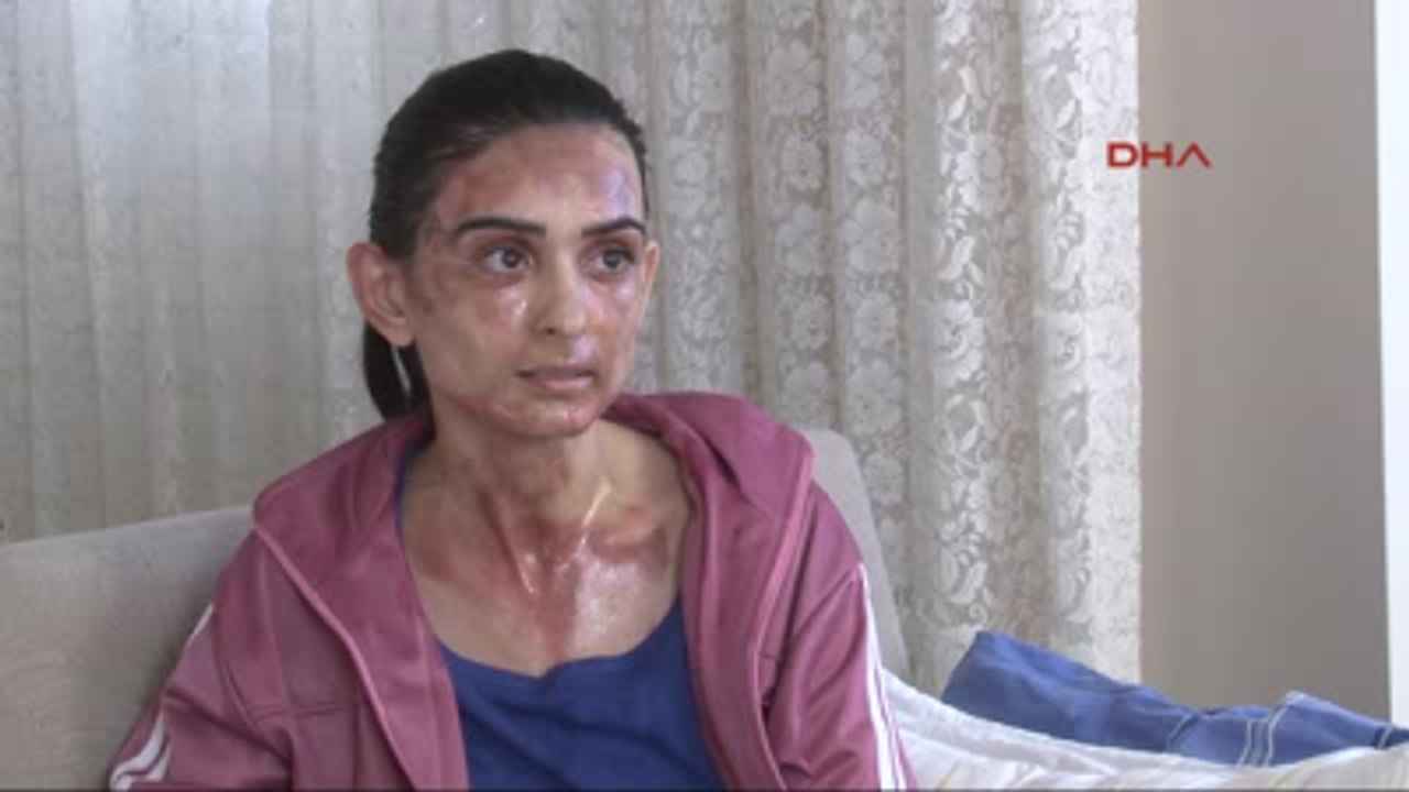 Izmir Aşure Yaptığı Düdüklü Tencere, Bomba Gibi Patladı