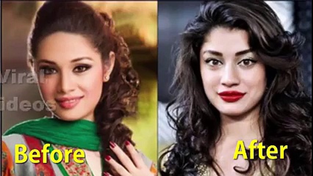 Actresses Who Spoiled Their Face With Plastic Surgery