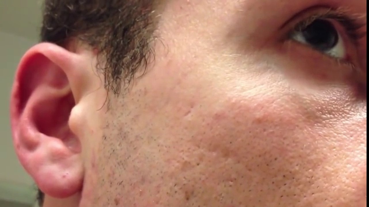 Man shaves his beard off but he got terrified when he found out...