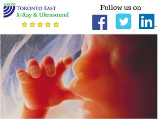 Quantum Ultrasound for Advanced Imaging