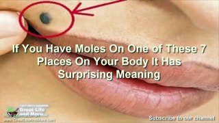 If You Have Moles On One of These 7 Places On Your Body It Has Surprising Meaning