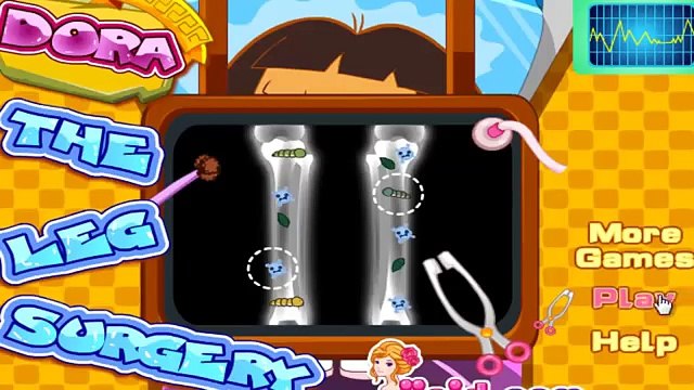 Dora The Explorer Doctor Caring - Dora Leg Surgery Doctor Games For Kids