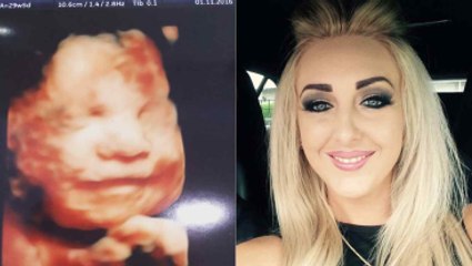 İngiltere'nin En Mutlu Bebeği! Anne Karnında Gülümsüyor