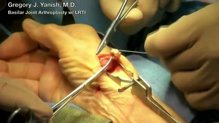 Brigada medica realizara cirugia de mano