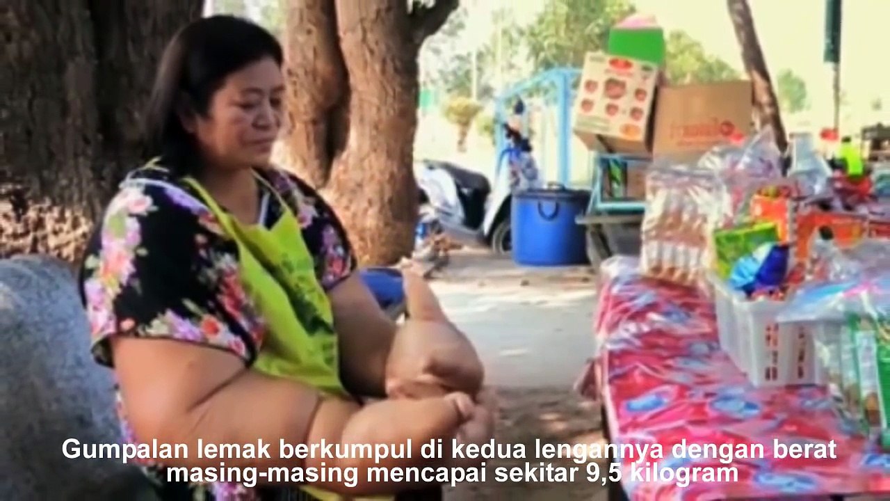 EDAN!! LIHAT Wanita Ini Miliki KEANEHAN MISTERIUS Mengundang PERHATIAN WARGA SEDUNIA