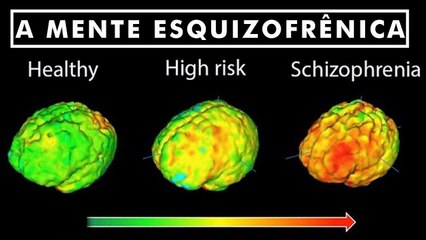 O Que Acontece dentro da Mente De Um Esquizofrênico