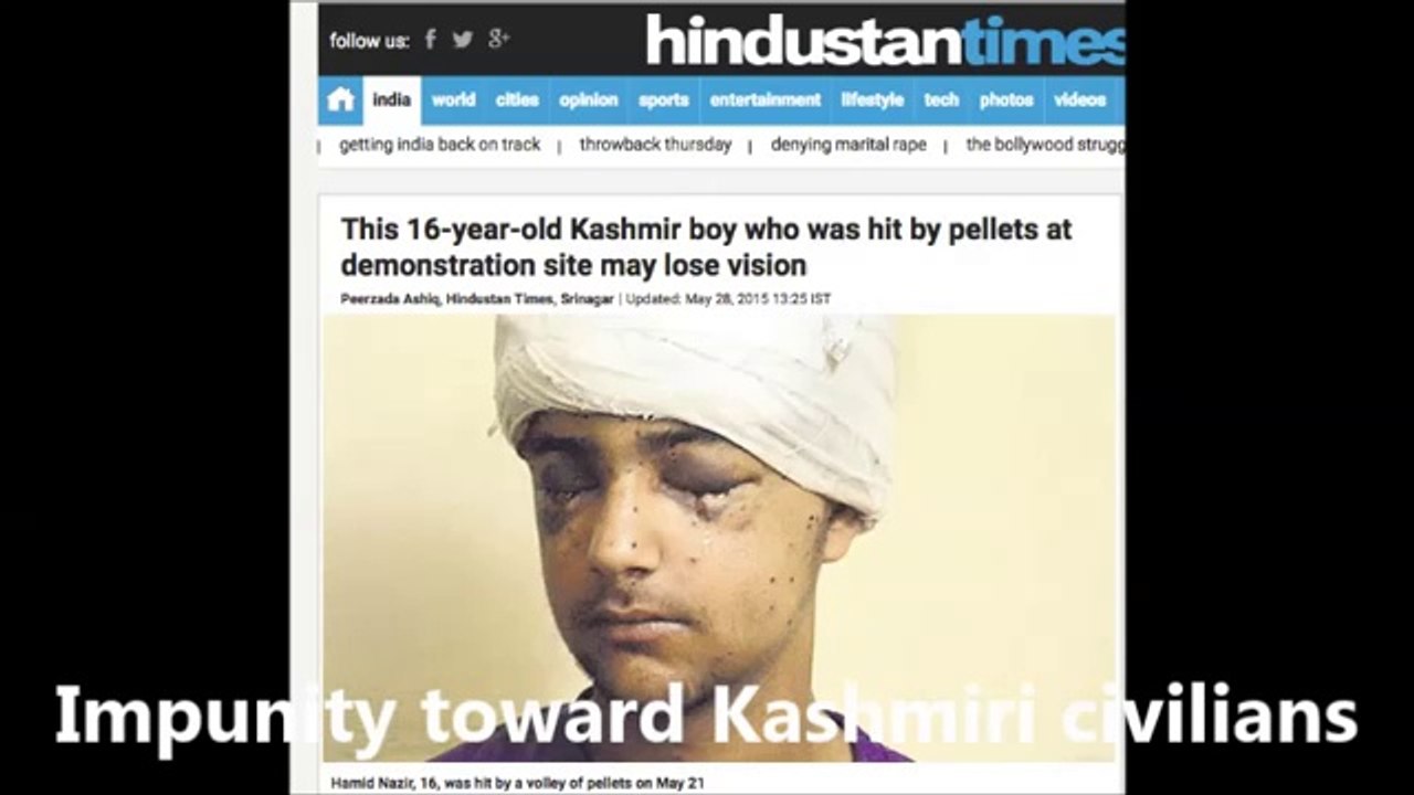 Indian Army crimes against civilians of Kashmir  Pellet GUN victim Kashmiri civilians!