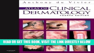 [READ] EBOOK Atlas of Clinical Dermatology, 4e (du Vivier, Atlas of Clinical Dermatology) ONLINE