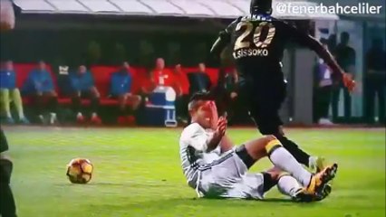 Robin Van Persie Suffers A Serious Eye Injury In Turkey!