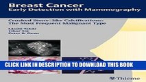 Best Seller Breast Cancer: Early Detection with Mammography: Crushed Stone-like Calcifications: