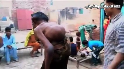 شاب باكستاني صاحب اكبر رأس في العالم .. biggest head in the world