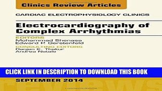 [PDF] Electrocardiography of Complex Arrhythmias, An Issue of Cardiac Electrophysiology Clinics,