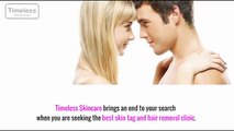 Best Laser Hair Removal Clinic In London - Timelessskincare.co.uk