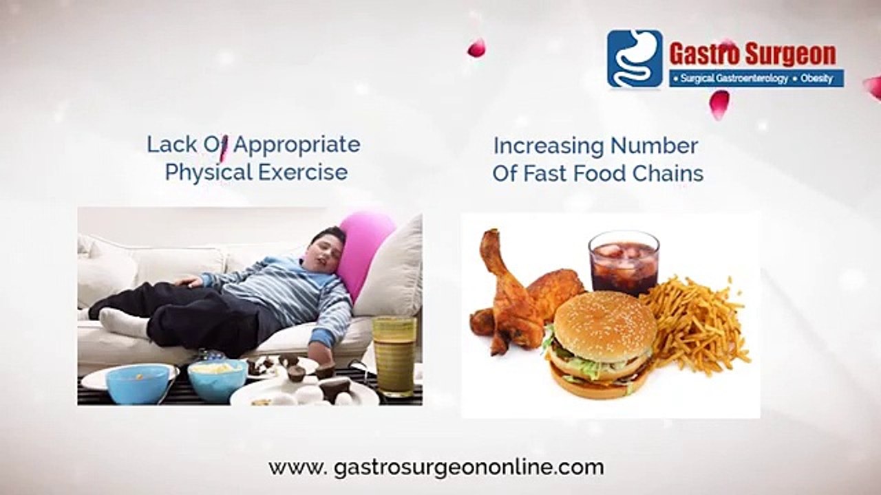 Obesity Treatment In Chennai | Bariatric Surgery In Tamil Nadu