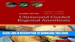 [PDF] Epub Ultrasound Guided Regional Anesthesia Full Online