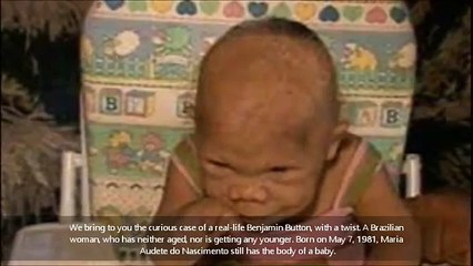 Elle ressemble à une enfant de 9 mois... Mais vous ne devinerez jamais quel âge elle a vraiment !