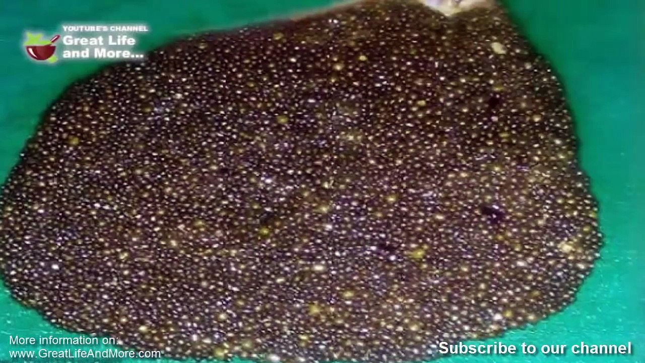 She Went To The Doctor With Stomach Pain, But When He Saw 12,000 Of THESE In Her He Screamed