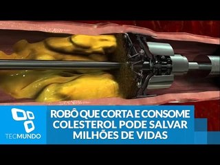 Robô que corta e consome colesterol pode salvar milhões de vidas