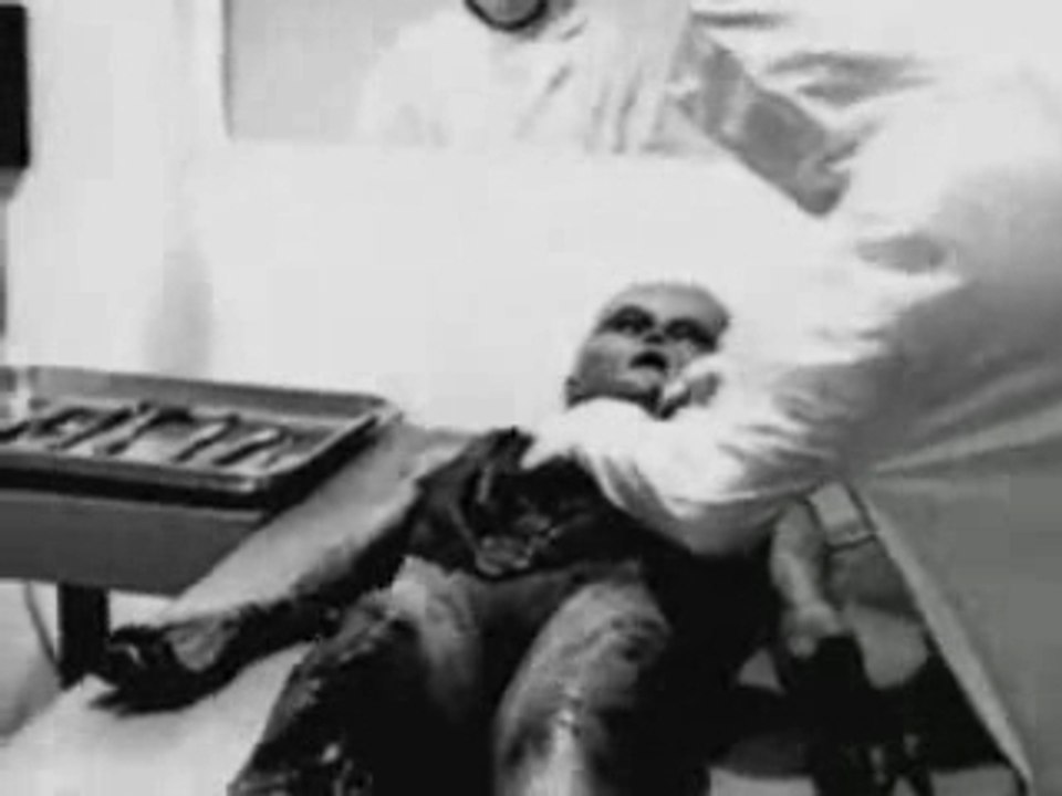 Autopsy de roswell