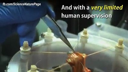 Autonomous Robotic Surgeon