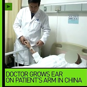 Chinese doctor grows ear on man’s ARM