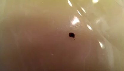 Elle enlève ce point noir sur sa jambe, mais finalement c’était quelque chose de bien plus terrible !