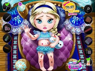 Baby Games For Kids - Baby Elsa Injured