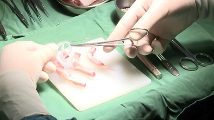 Une oreille pousse dans le bras d’un homme après une opération chirurgicale !