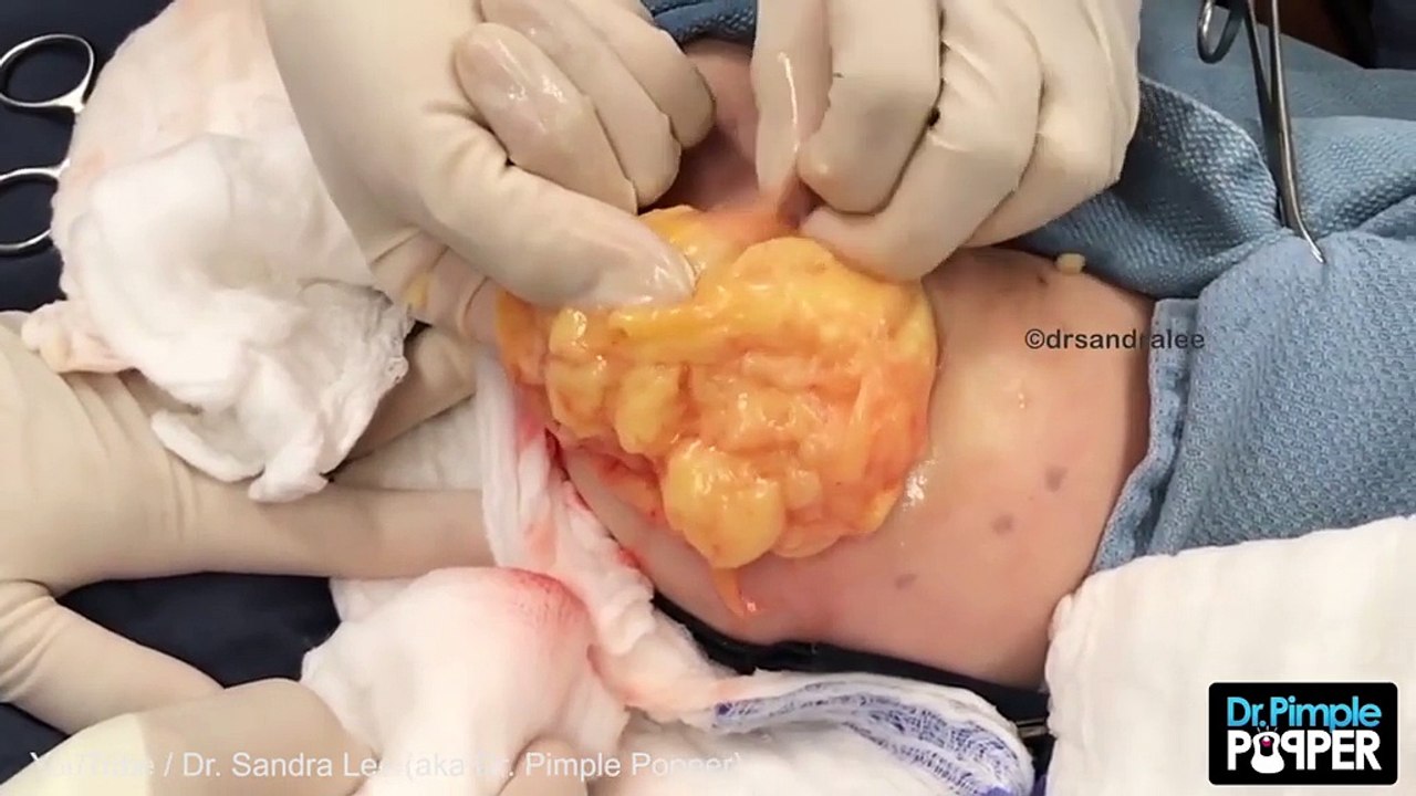 Elle se présente chez le docteur, mais quand elle lui retire ça du bras? OH MY GOD!!!