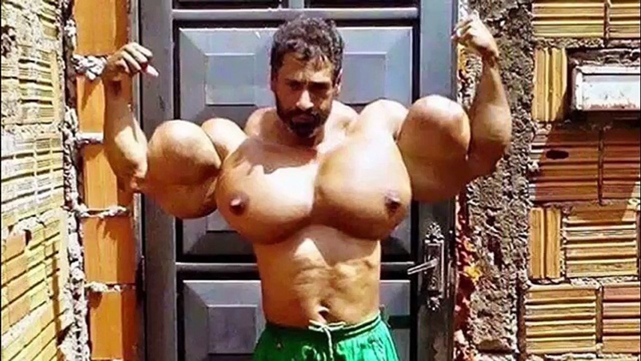 The Biggest Synthol Freak Ever