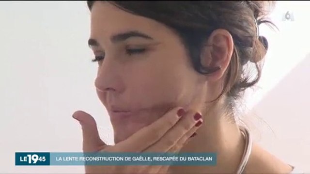 Cette survivante des attentats du Bataclan touchée par deux balles au visage raconte sa lente reconstruction