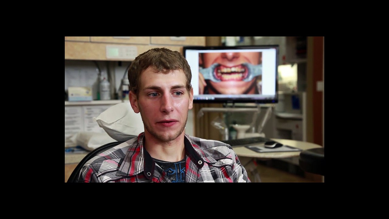 All-on-4 Dental Implants vs. The G4 Implant Solution
