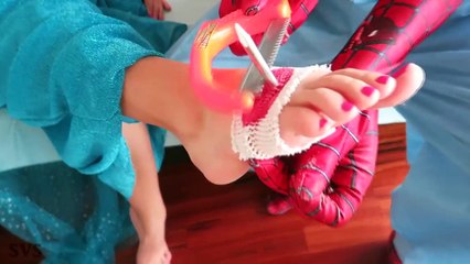 FROZEN ELSA vs DOCTOR! Elsa got HURT! Nail in FOOT! w/ Spiderman vs Joker - Superheroes Real Life