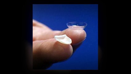 Causes of Dental Implant Failure