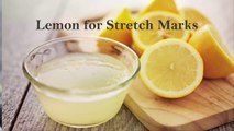 How to Remove Stretch Marks Naturally at Home