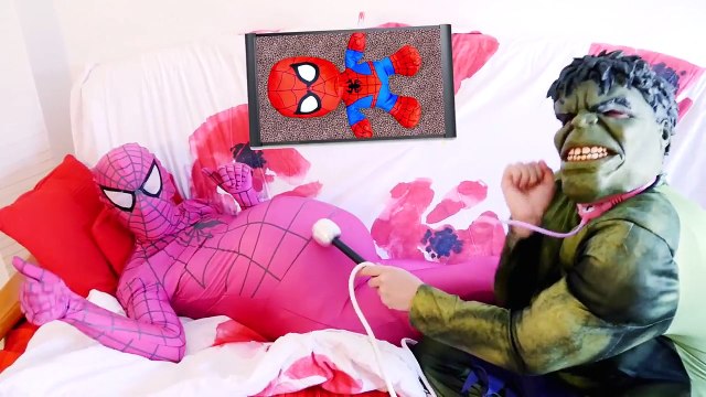 Spiderman & Pregnant Pink Spidergirl vs Doctor! Ft Evil Frozen Elsa vs King Kong Superhero Real Life