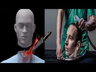 İnsandan İnsana Kafa Nakli Mümkün mü?