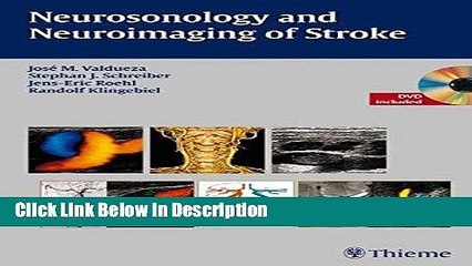 [PDF] Neurosonology and Neuroimaging of Stroke [Download] Online