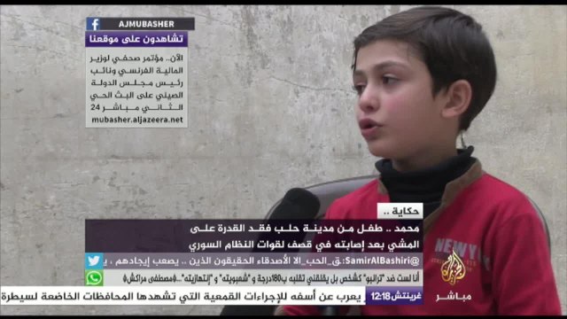 حكاية.. الطفل الحلبي محمد الذي فقد قدرته على المشي بعد إصابته بقصف النظام السوري